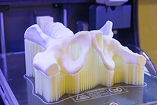 Optimierung chirurgischer Eingriffe dank 3D-Druckern von BCN3D